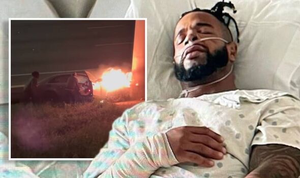 ‘Challenge’ Star Nelson Thomas Shares Gruesome Photos Of Car Accident Injuries