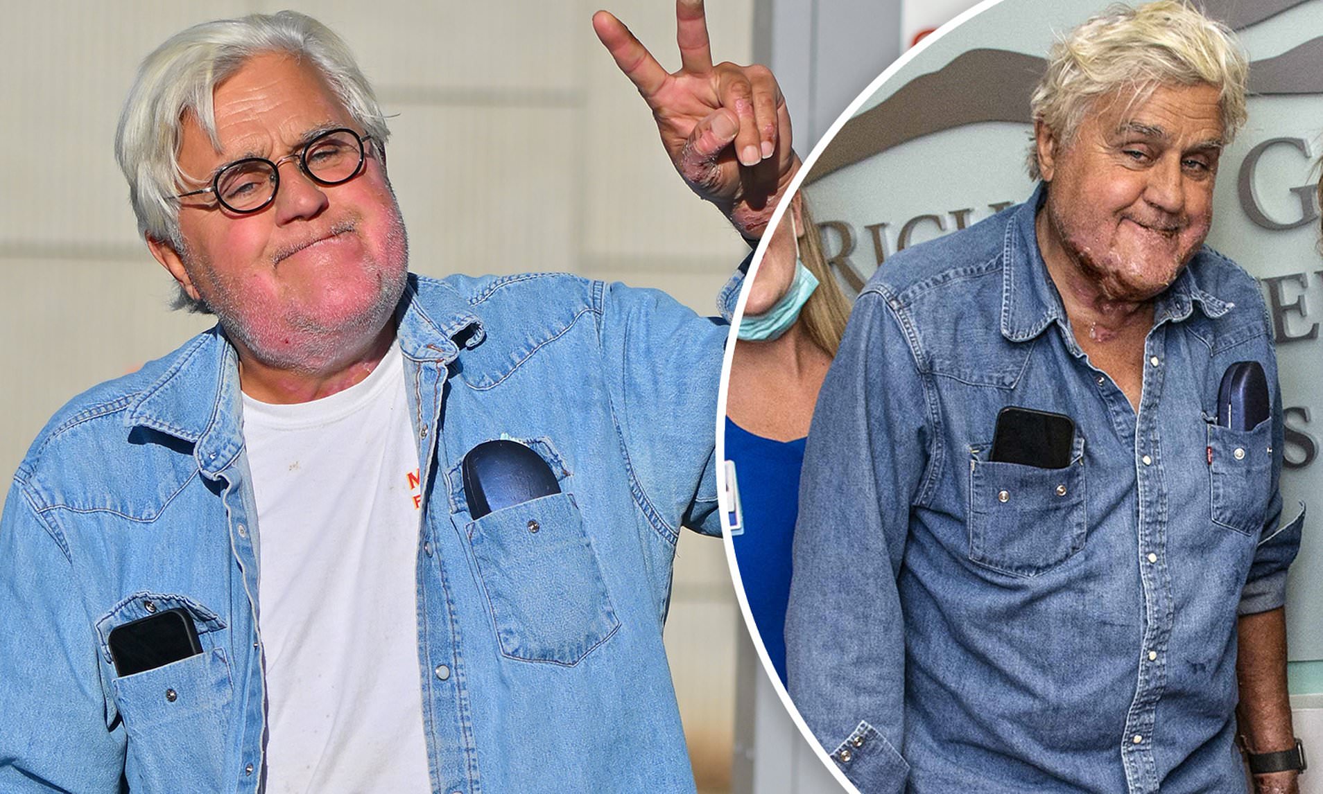 Jay Leno Provides An Update On His Health Following A Car Fire And A Motorbike Accident