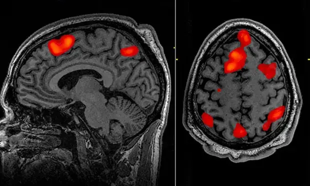 Scientists Use Brain Scans And AI To ‘Decode’ Thoughts