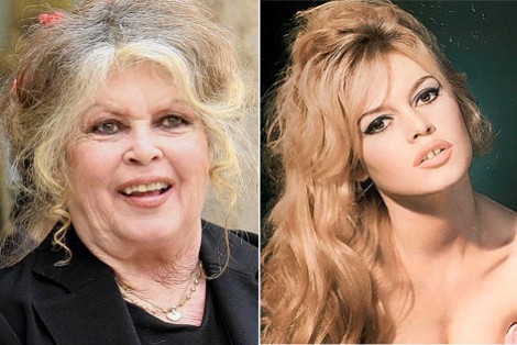 Brigitte Bardot, 88, Is Having Trouble Breathing As First Responders Come To Her Home