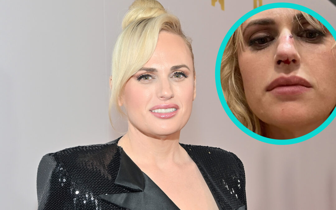 Rebel Wilson Was Hospitalized Following The Act In Bride Hard