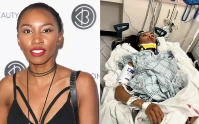 Marvel Actress Carrie Bernans Was Hit By A Car During The New Year’s Eve Celebration, And She Suffered Horrifying Injuries
