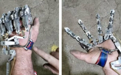 After The Medical Insurance Company Declined To Pay For A Bionic Hand, A Man Created His Own Working One