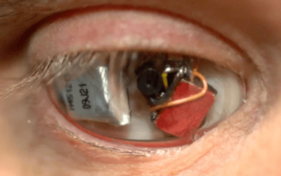 A Man Who Lost An Eye Reveals Why He Replaced It With A Wireless Camera